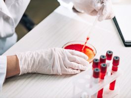 Blood Clotting Research